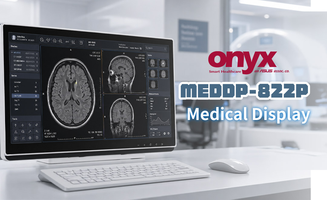 MEDDP-822P 医療用ディスプレイ:臨床現場のために設計されたクリアな画像表示