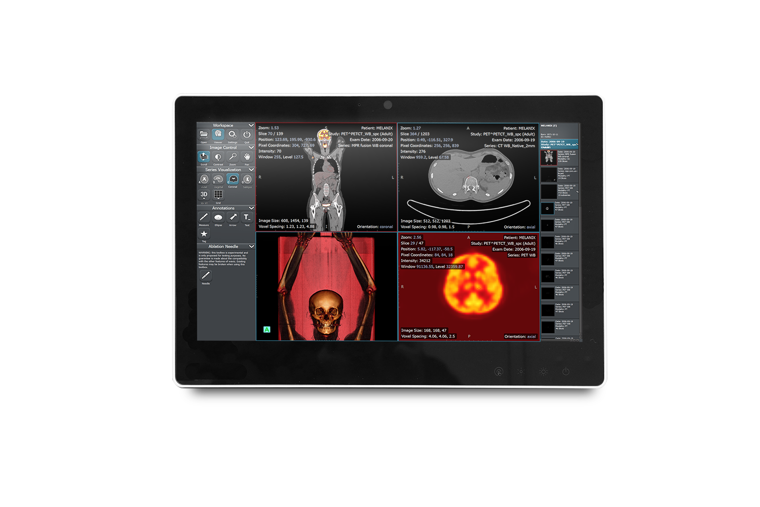 SMA-1533 | 医療用パネルPC | Onyx Healthcare Inc.
