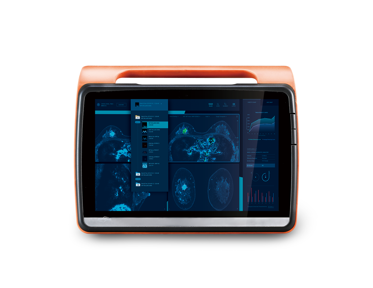 MD116E | Medical Tablet | Onyx Healthcare Inc.